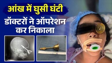 9 वर्षीय मासूम के आंख से होते हुए दिमाग में घुसी घंटी, डॉक्टरों ने ऑपरेशन कर निकाला 9 वर्षीय मासूम के आंख से होते हुए दिमाग में घुसी घंटी, डॉक्टरों ने ऑपरेशन कर निकाला
