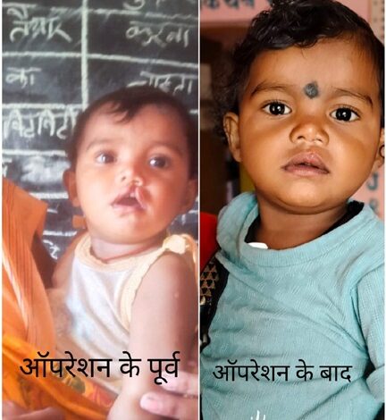 शासन की योजना से दूर हुई बेटी के भविष्य की चिंता, चिरायु दल ने लौटाई मासूम रंजना की मुस्कान