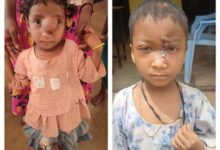 पिता के साये और आर्थिक तंगी के बीच चिरायु योजना बनी सहारा,अंजलि को मिला नया जीवन