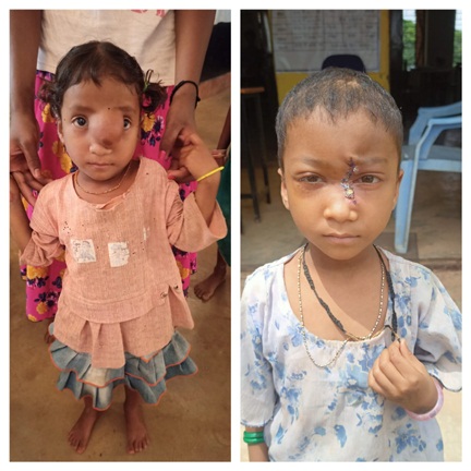 पिता के साये और आर्थिक तंगी के बीच चिरायु योजना बनी सहारा,अंजलि को मिला नया जीवन