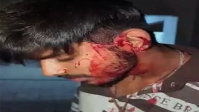 रायपुर में प्रॉपर्टी डीलर के बेटे पर चाकू से हमला, इलाके में हड़कंप रायपुर में प्रॉपर्टी डीलर के बेटे पर चाकू से हमला, इलाके में हड़कंप