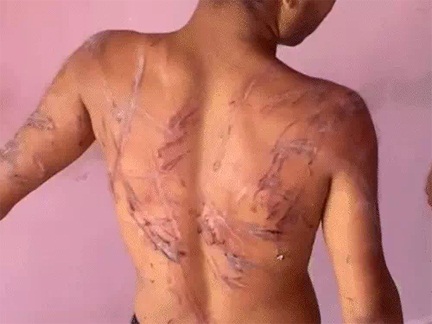 VIDEO वायरल: रायपुर में युवक को क्रूरता से पीटा और घायल किया गया VIDEO वायरल: रायपुर में युवक को क्रूरता से पीटा और घायल किया गया