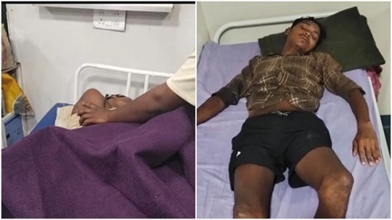 दंतेवाड़ा के चंदेनार बाजार में आकाशीय बिजली गिरी, 11 लोग चपेट में आए